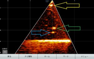 エコマップウルトラ LVS12(ライトライブスコープ) | 琵琶湖ガイド 予約 